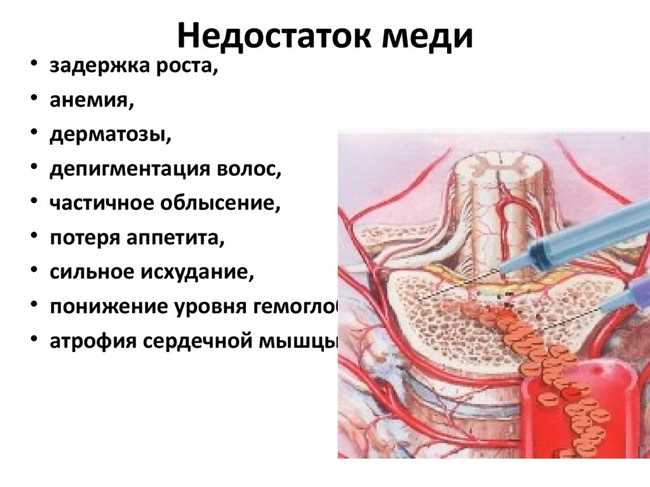 Чем опасен дефицит меди в организме?