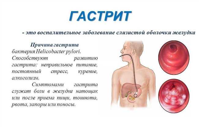 Определение блудняка