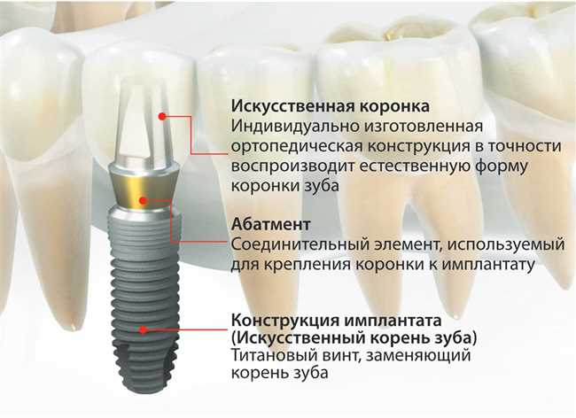 Что такое сетап: основные принципы и компоненты