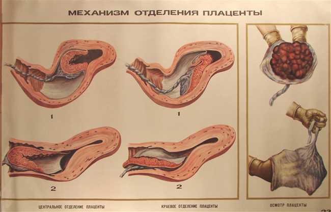 2. Истоки термина 