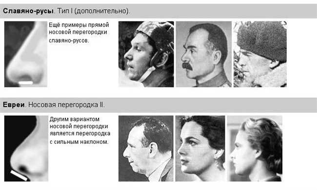 Какие мочки ушей у евреев фото Как распознать евреев: особенности еврейского сообщества и специфические черты