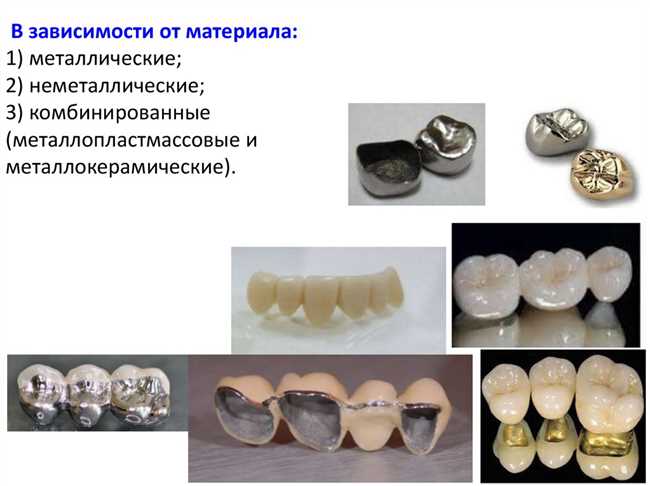 Какие металлы используются в производстве зубных пломб?