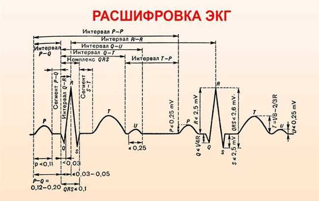 Заключение