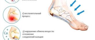 Характеристики и методы лечения таньки-шлёп ноги